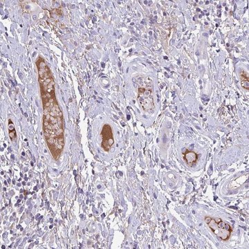 Anti-F13B antibody produced in rabbit