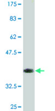 Monoclonal Anti-ZBTB25, (C-terminal) antibody produced