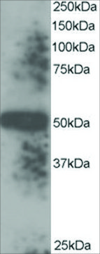 Anti-ENDOPDI/TXNDC5 antibody produced in goat