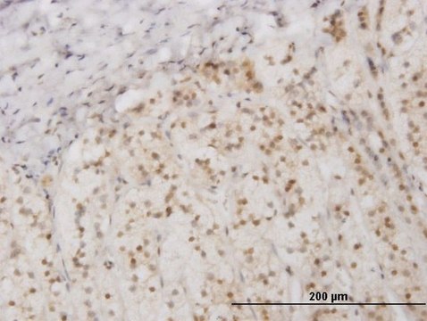 Monoclonal Anti-EIF2AK2, (N-terminal) antibody produced