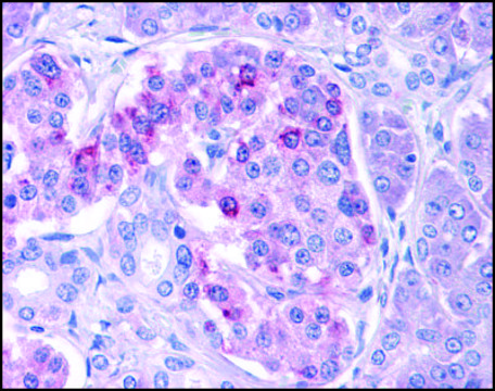 Anti-IKK? antibody produced in rabbit