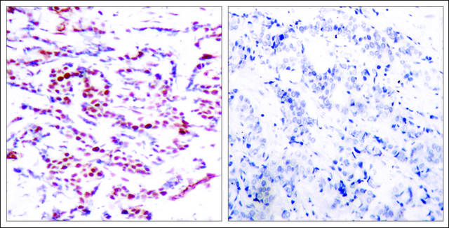 Anti-phospho-ATF2 (pThr?¹ or pThr?³) antibody