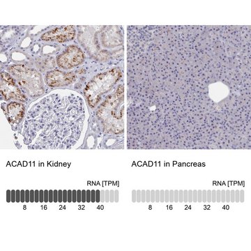 Anti-ACAD11 antibody produced in rabbit