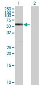 Anti-CBS antibody produced in rabbit