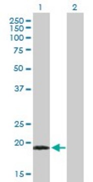 Anti-TPPP3 antibody produced in mouse