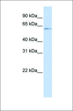 Anti-NFIC antibody produced in rabbit