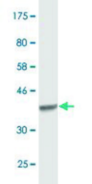 Monoclonal Anti-ACO1, (C-terminal) antibody produced
