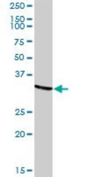 Anti-TARBP2 antibody produced in rabbit