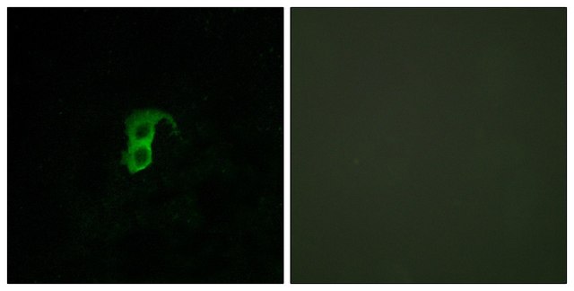 Anti-GPR87 antibody produced in rabbit