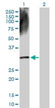 Anti-DECR2 antibody produced in rabbit