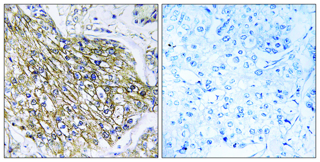 Anti-LPHN2 antibody produced in rabbit