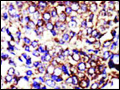 Anti-AGL (N-term) antibody produced in