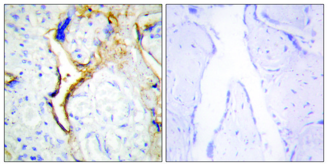 Anti-CKI-? antibody produced in rabbit