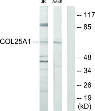 Anti-Collagen XXV ?1 antibody produced