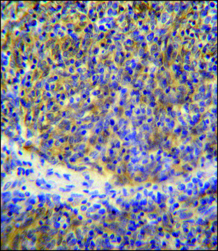 ANTI-PSMB11 (C-TERM) antibody produced in