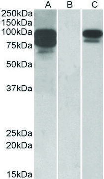 Anti-PCSK9 antibody produced in goat