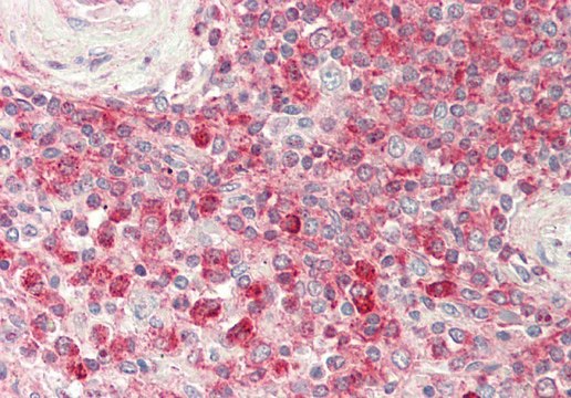 Anti-PTDSS1 antibody produced in rabbit
