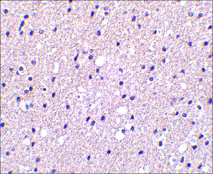 Anti-Presenilin1 antibody produced in rabbit