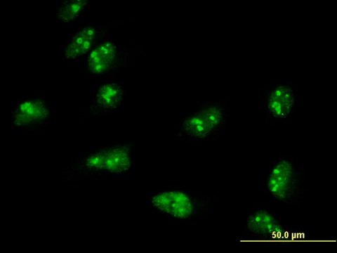 Monoclonal Anti-TASP1 antibody produced in