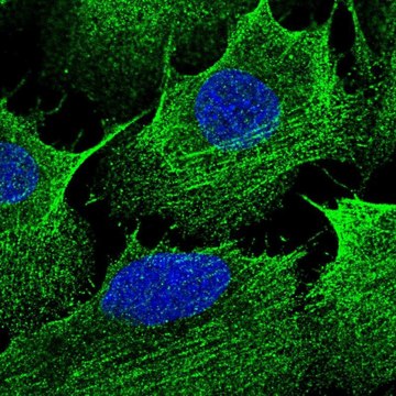 Anti-CCDC69 antibody produced in rabbit