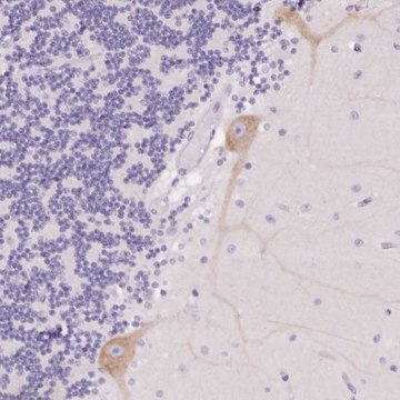 Anti-PNLIPRP3 antibody produced in rabbit