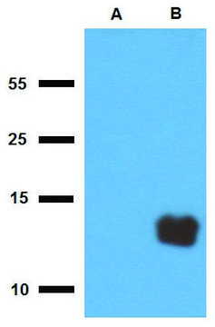 Anti-Tb10.3 (M. tuberculosis) antibody produced