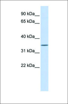 Anti-WNT1 antibody produced in rabbit