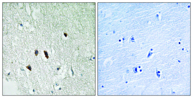 Anti-RIPK2 antibody produced in rabbit