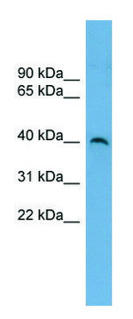 Anti-SUV39H2 antibody produced in rabbit