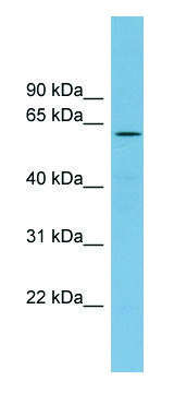 Anti-RIOK2 antibody produced in rabbit