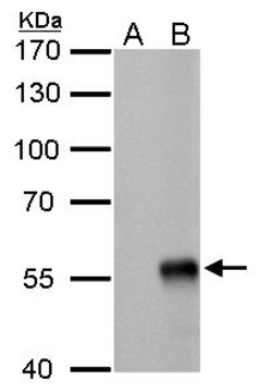 Monoclonal Anti-Influenza A virus NP