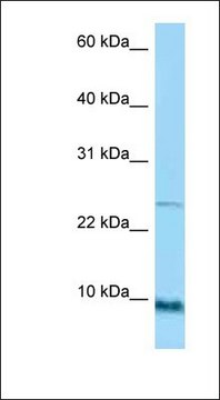 Anti-SPRR1A antibody produced in rabbit