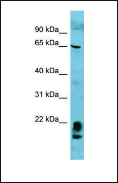 Anti-FAM134A, (N-terminal) antibody produced in