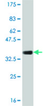 Monoclonal Anti-COL23A1 antibody produced in