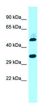 Anti-CNOT9 antibody produced in rabbit