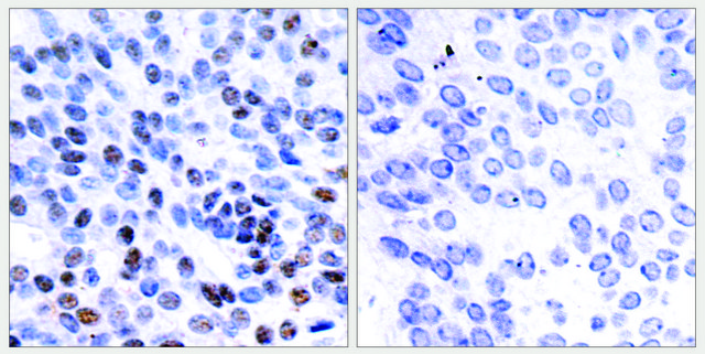 Anti-JUNB antibody produced in rabbit