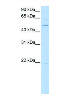 Anti-RORB antibody produced in rabbit