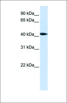Anti-STK17A antibody produced in rabbit