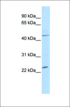 Anti-NKX3-1 (ab2) antibody produced in