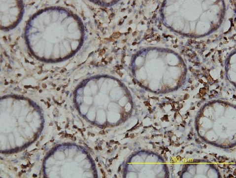 Monoclonal Anti-CALR antibody produced in
