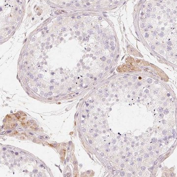 Anti-CFHR2 antibody produced in rabbit