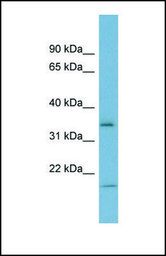 Anti-IGFBP2 antibody produced in rabbit