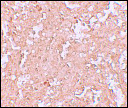 Anti-ZBTB8 antibody produced in rabbit