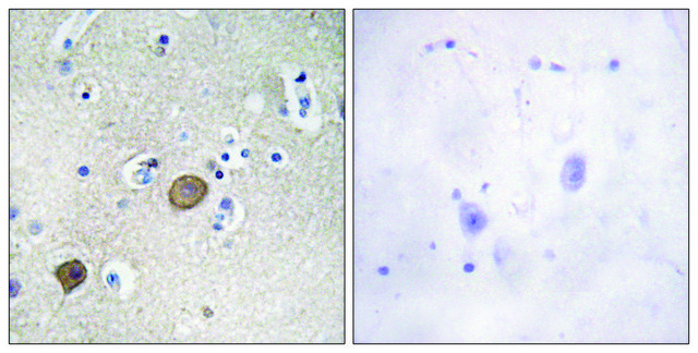 Anti-Catenin-?1 antibody produced in rabbit