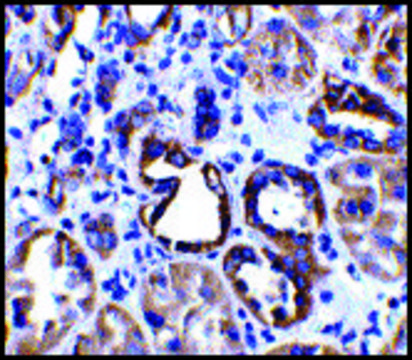 Anti-ACE2 antibody produced in rabbit