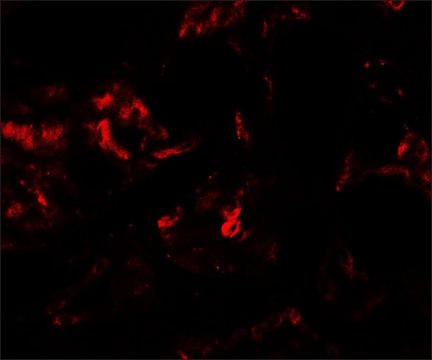Anti-PLA1A antibody produced in rabbit