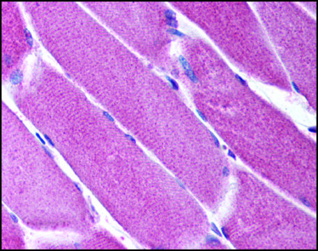 Anti-ORAI2 antibody produced in rabbit