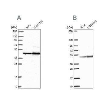 Anti-ARFGAP1 antibody produced in rabbit