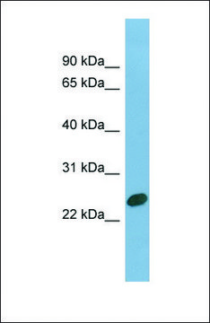Anti-CHMP1B, (N-terminal) antibody produced in