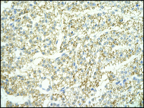 Anti-LSM4 antibody produced in rabbit